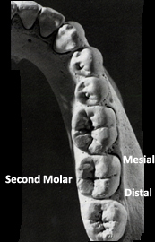 Bird's eye view of part of a human jaw, showing the position of the second molar.